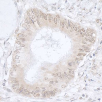 Rabbit USP36/DUB1 Antibody