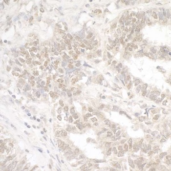 Rabbit G9A/EHMT2 Antibody
