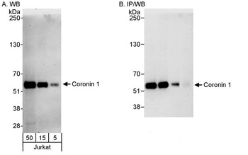 Rabbit Coronin 1 Antibody