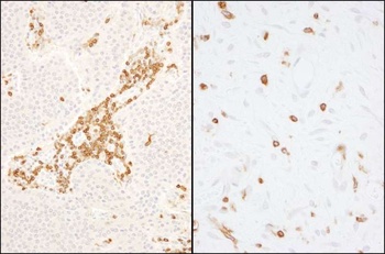 Rabbit Coronin 1 Antibody