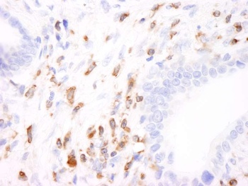 Rabbit Coronin 1 Antibody