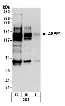 Rabbit ASPP1 Antibody