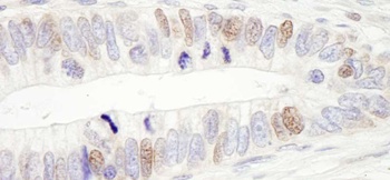 Rabbit USP10 Antibody