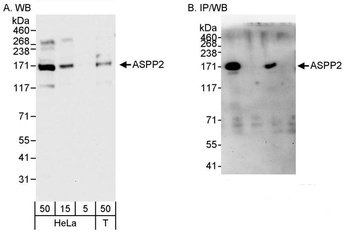 Rabbit ASPP2 Antibody
