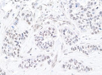 Rabbit TIF1 Alpha/TRIM24 Antibody