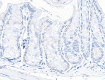 Rabbit TIF1 Alpha/TRIM24 Antibody
