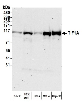 Rabbit TIF1 Alpha/TRIM24 Antibody
