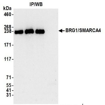 Rabbit BRG1/SMARCA4 Antibody