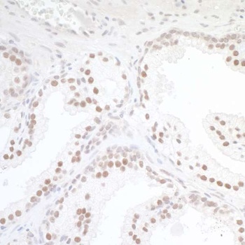 Rabbit TORC1 Antibody