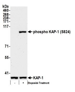 Rabbit Phospho KAP-1 (S824) Antibody