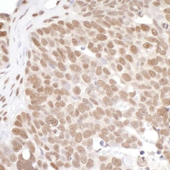 Rabbit PRMT1 Antibody