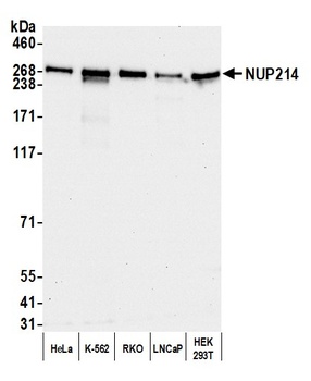 Rabbit NUP214 Antibody