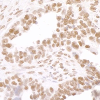Rabbit Phospho RNA Polymerase II (S2) Antibody
