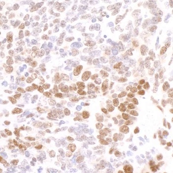 Rabbit Phospho RNA Polymerase II (S2) Antibody