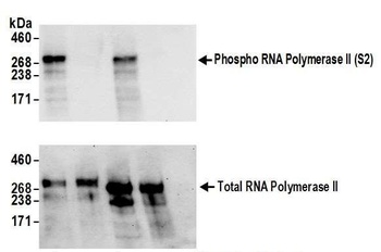 Rabbit Phospho RNA Polymerase II (S2) Antibody