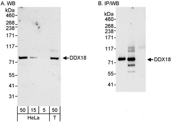 Rabbit DDX18 Antibody