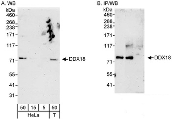 Rabbit DDX18 Antibody