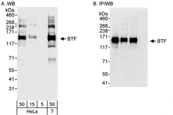 Rabbit BTF Antibody