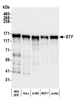 Rabbit BTF Antibody