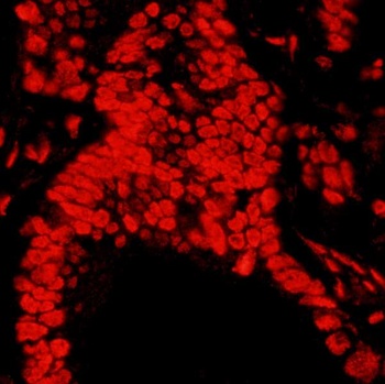 Rabbit Matrin 3 Antibody
