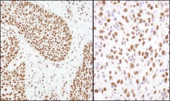 Rabbit Matrin 3 Antibody