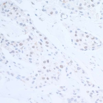 Rabbit EDD1 Antibody