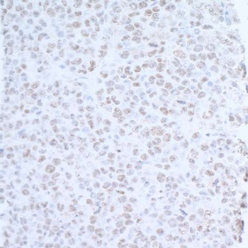 Rabbit EDD1 Antibody