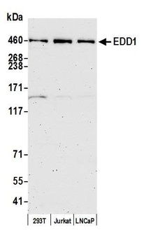 Rabbit EDD1 Antibody