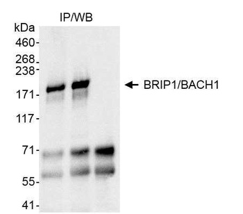 Rabbit BRIP1/BACH1 Antibody