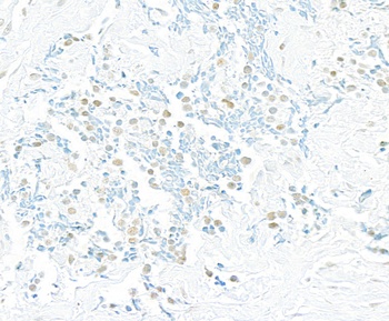 Rabbit Pds5B Antibody
