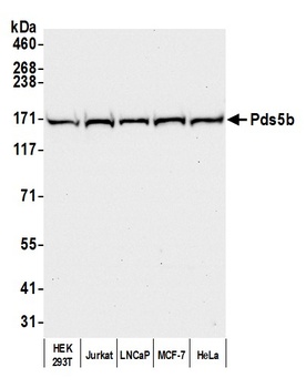 Rabbit Pds5B Antibody