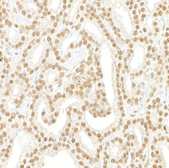 Rabbit Pds5B Antibody