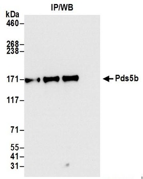 Rabbit Pds5B Antibody