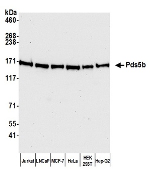 Rabbit Pds5B Antibody