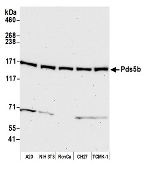 Rabbit Pds5B Antibody