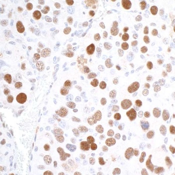 Rabbit RCH1/KPNA2 Antibody