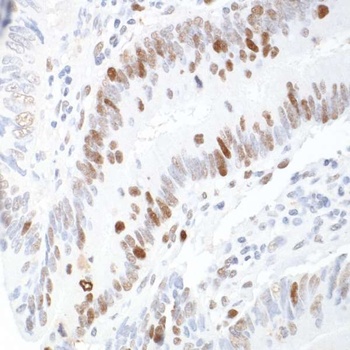 Rabbit RCH1/KPNA2 Antibody