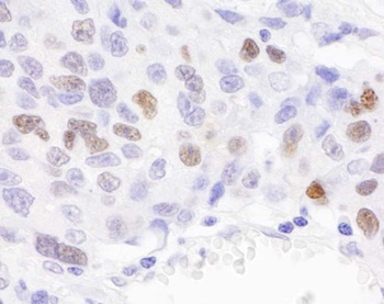 Rabbit RCH1/KPNA2 Antibody