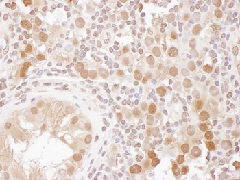 Rabbit CSE1 Antibody