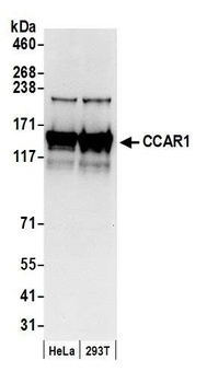 Rabbit CCAR1 Antibody