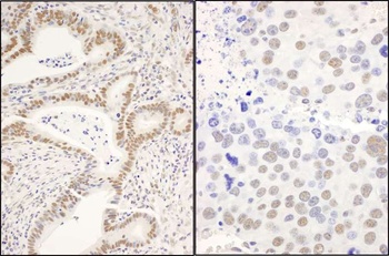 Rabbit CCAR1 Antibody