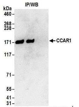 Rabbit CCAR1 Antibody