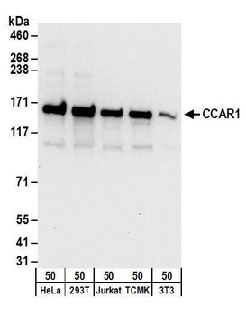 Rabbit CCAR1 Antibody