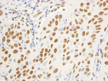 Rabbit DBC1/p30 DBC Antibody