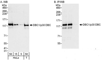 Rabbit DBC1/p30 DBC Antibody