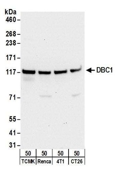 Rabbit DBC1/p30 DBC Antibody