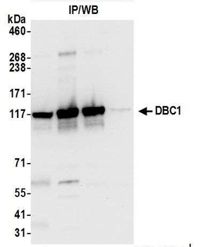 Rabbit DBC1/p30 DBC Antibody