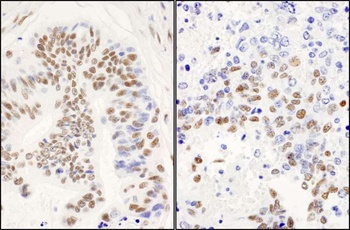 Rabbit DBC1/p30 DBC Antibody