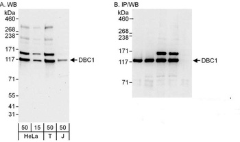 Rabbit DBC1/p30 DBC Antibody