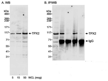 Rabbit TPX2 Antibody